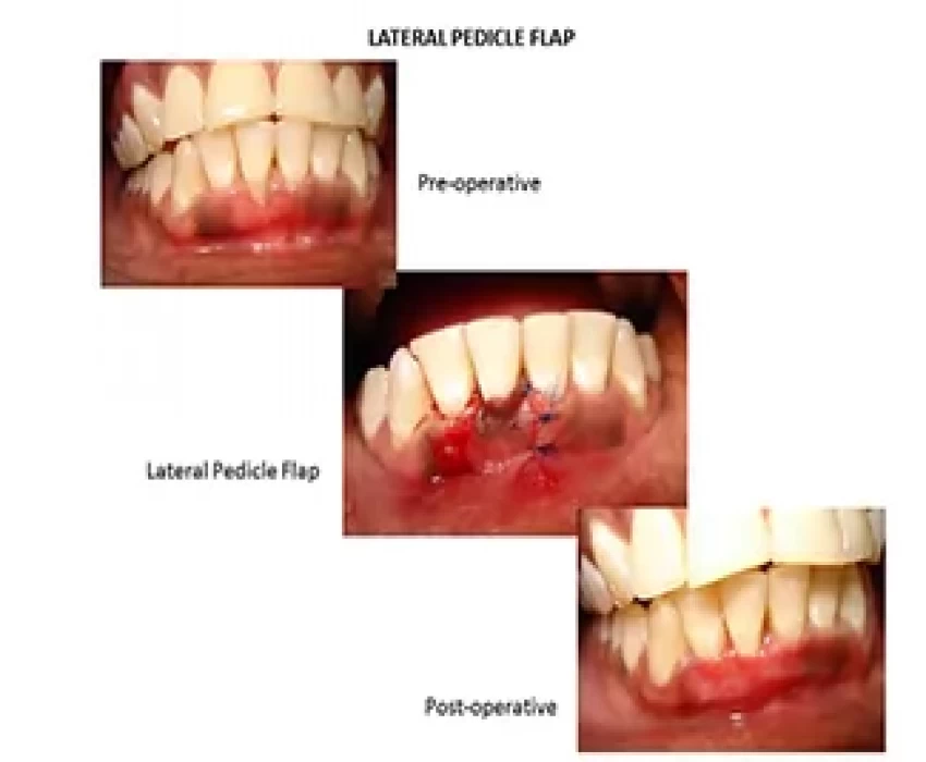 saraswati dental college