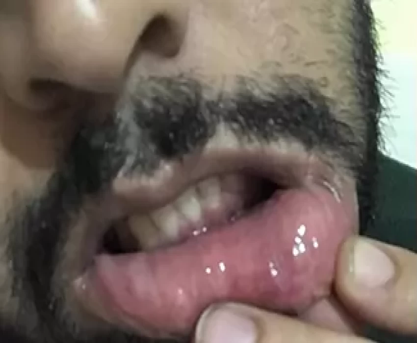 saraswati dental college