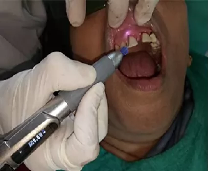 saraswati dental college