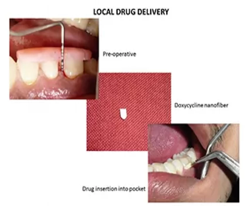 saraswati dental college