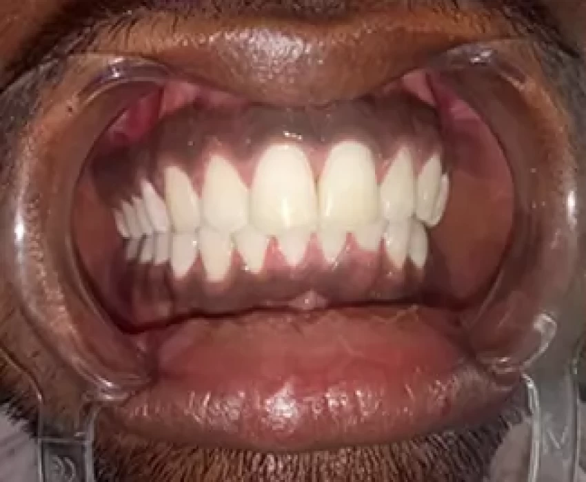 saraswati dental college