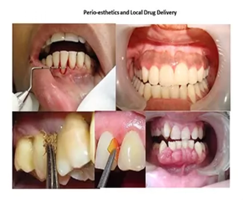 saraswati dental college