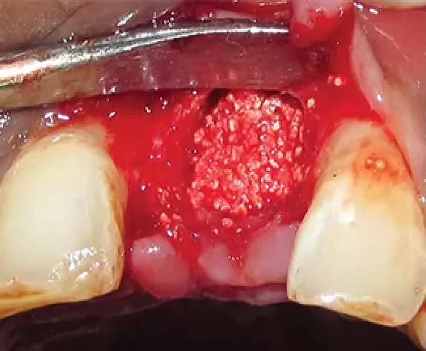 saraswati dental college