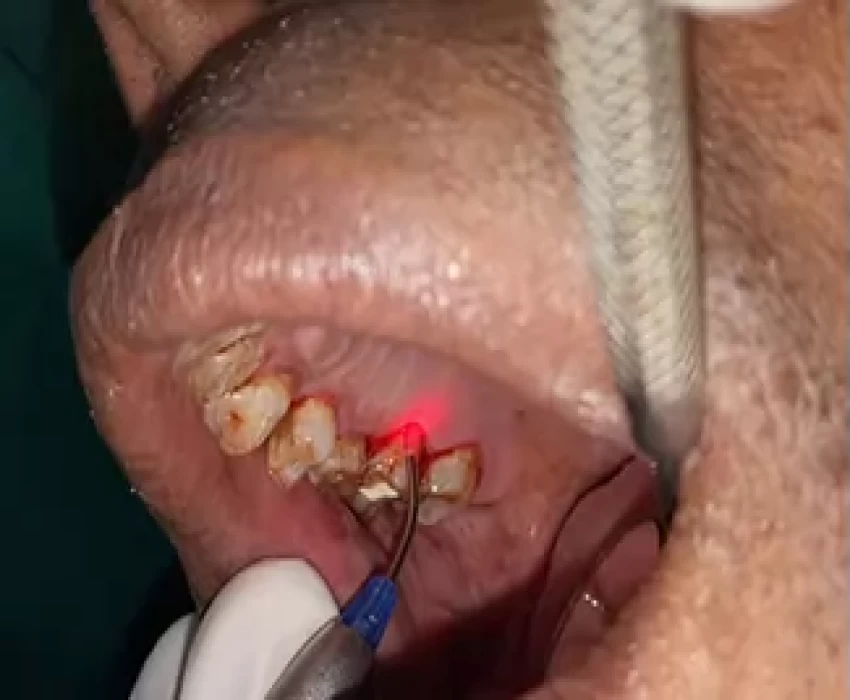 saraswati dental college