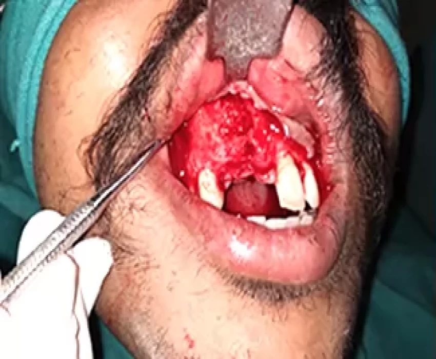 saraswati dental college