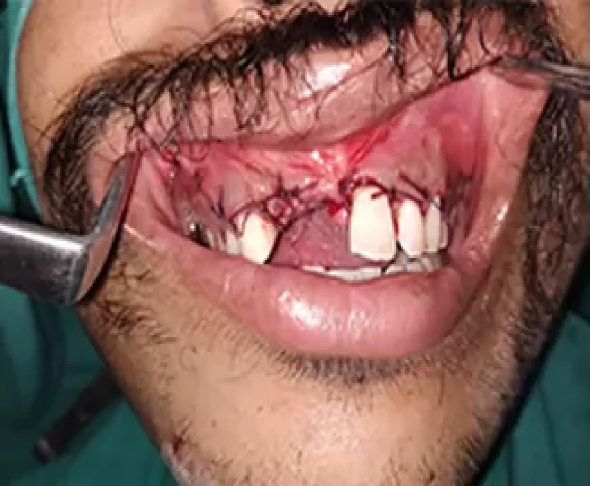 saraswati dental college