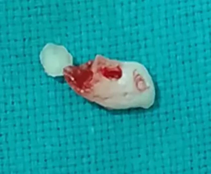 saraswati dental college