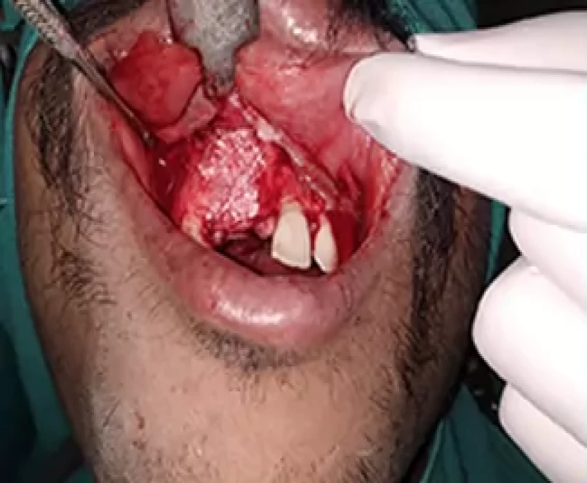 saraswati dental college