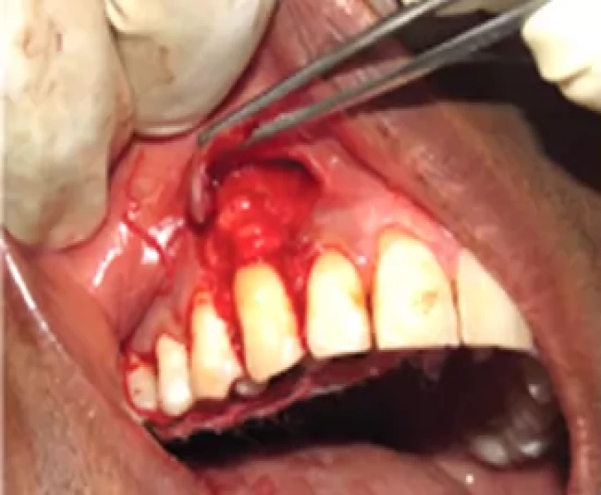 saraswati dental college