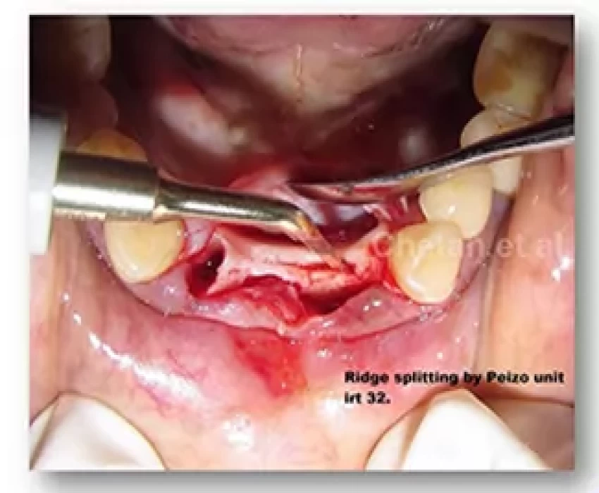 saraswati dental college