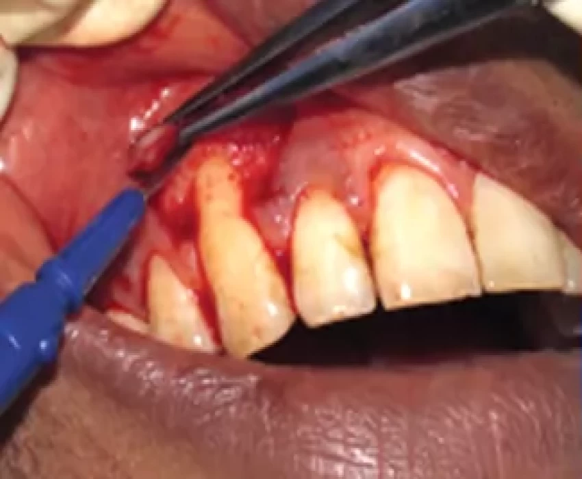 saraswati dental college