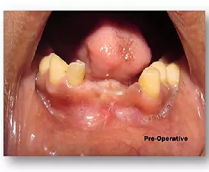 saraswati dental college