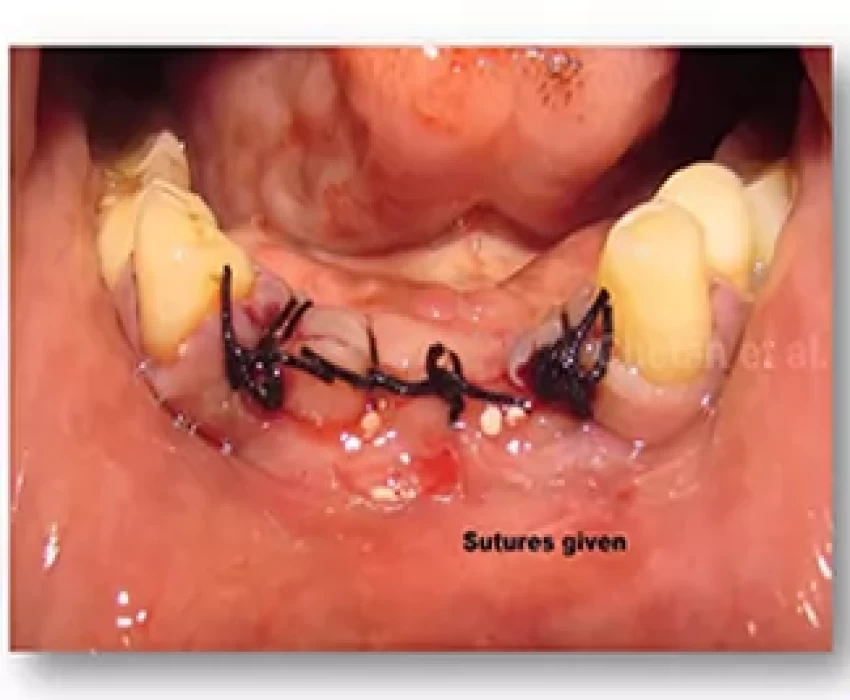 saraswati dental college