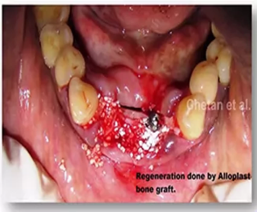 saraswati dental college