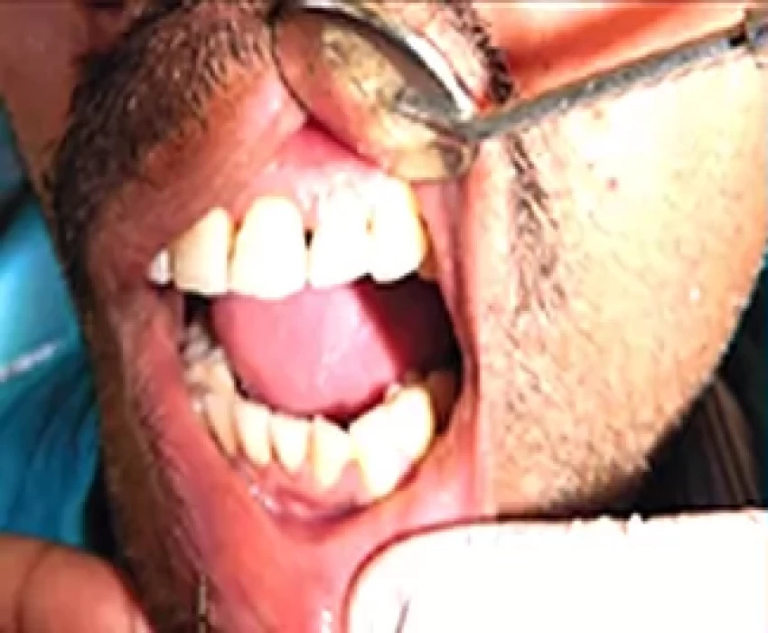 saraswati dental college