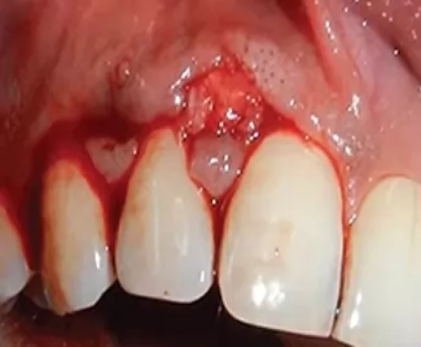 saraswati dental college