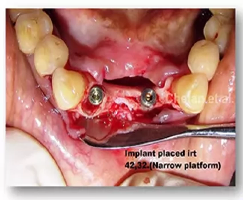 saraswati dental college