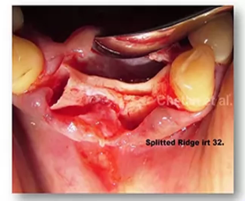 saraswati dental college