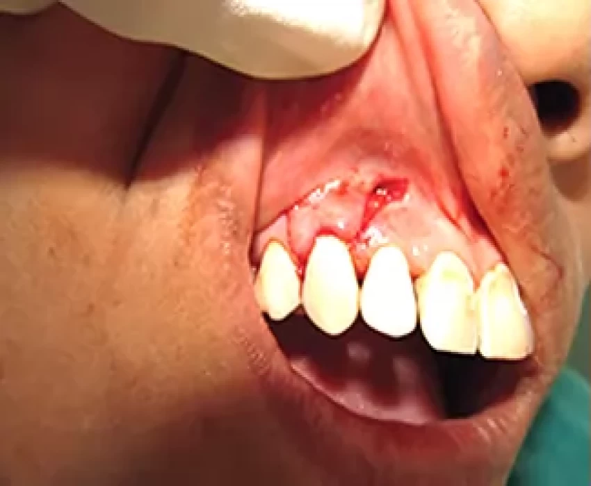 saraswati dental college