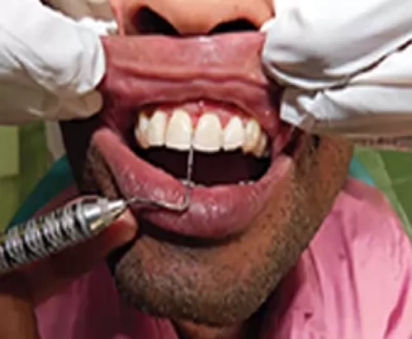 saraswati dental college