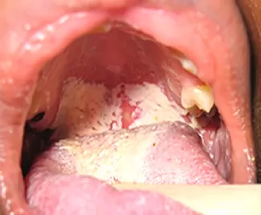 saraswati dental college