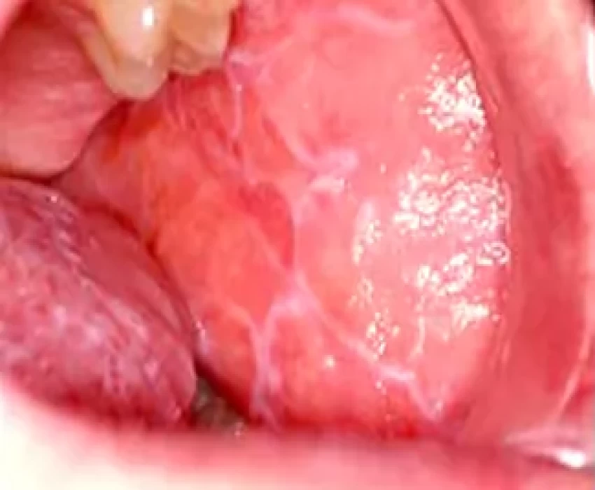 saraswati dental college