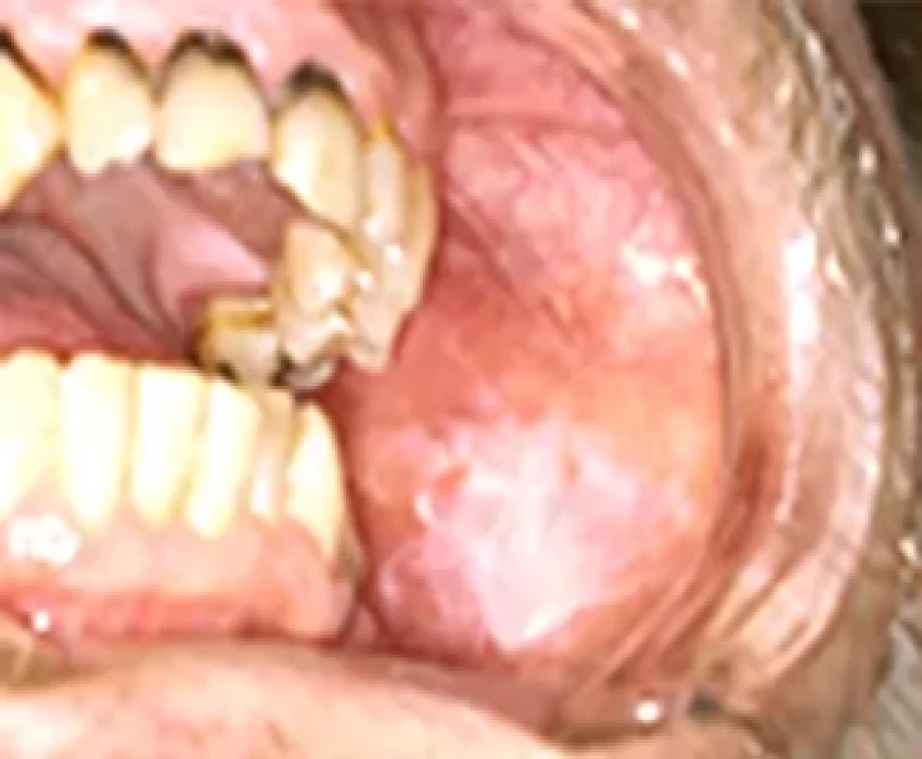 saraswati dental college