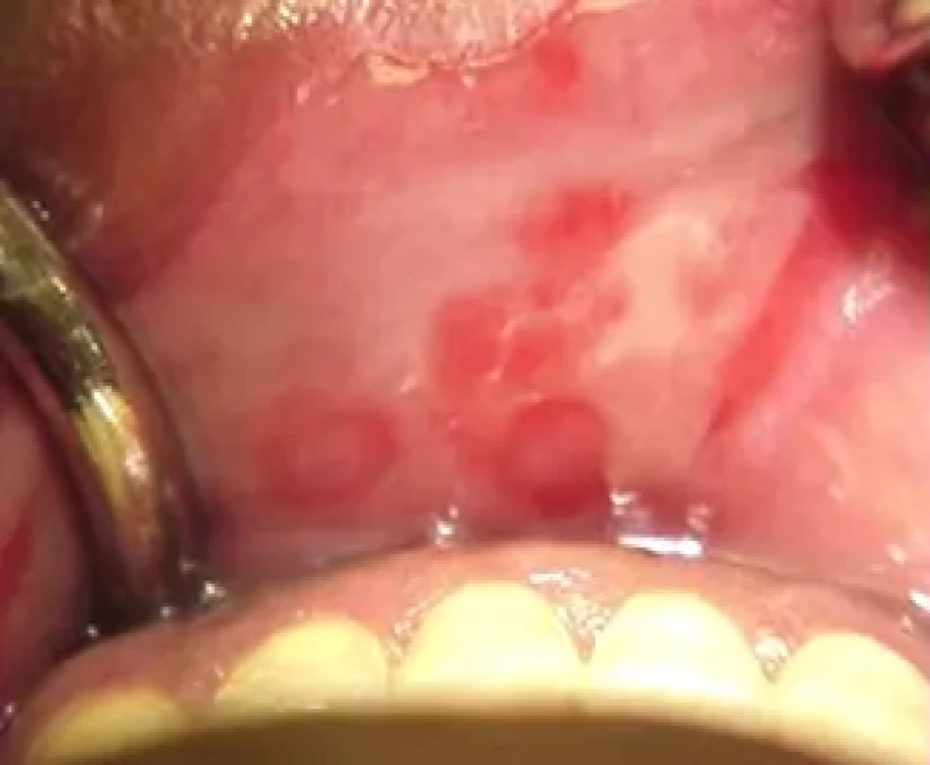 saraswati dental college