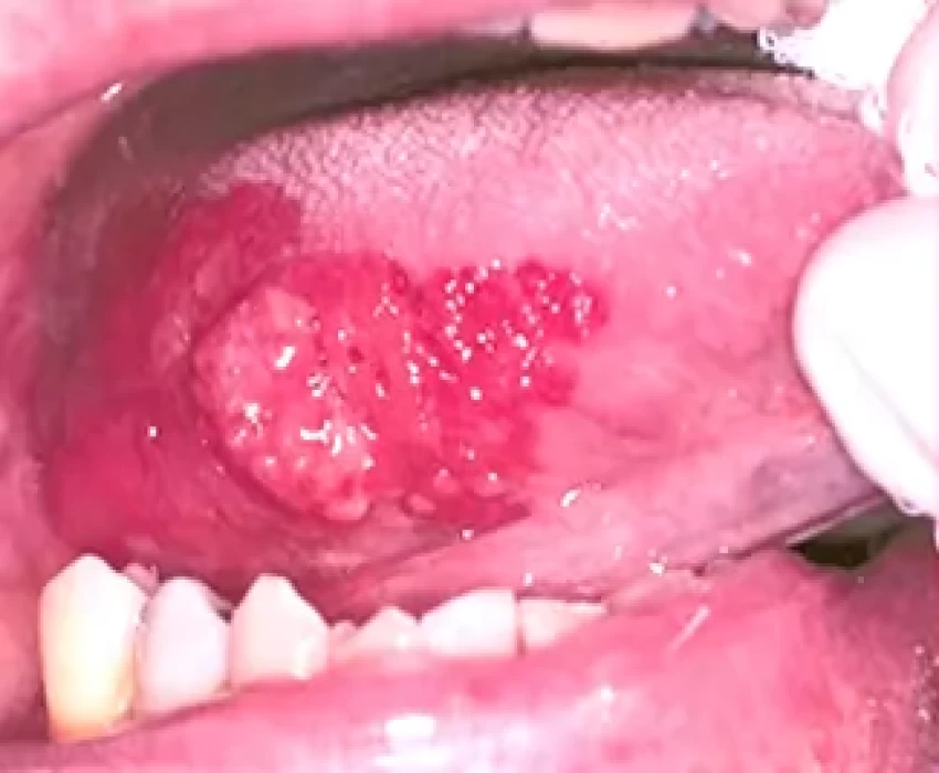 saraswati dental college