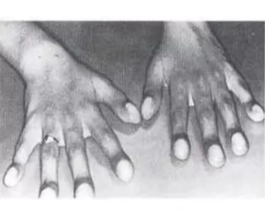 saraswati dental college