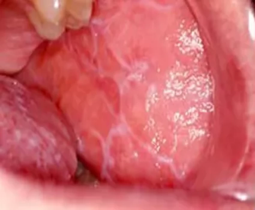 saraswati dental college