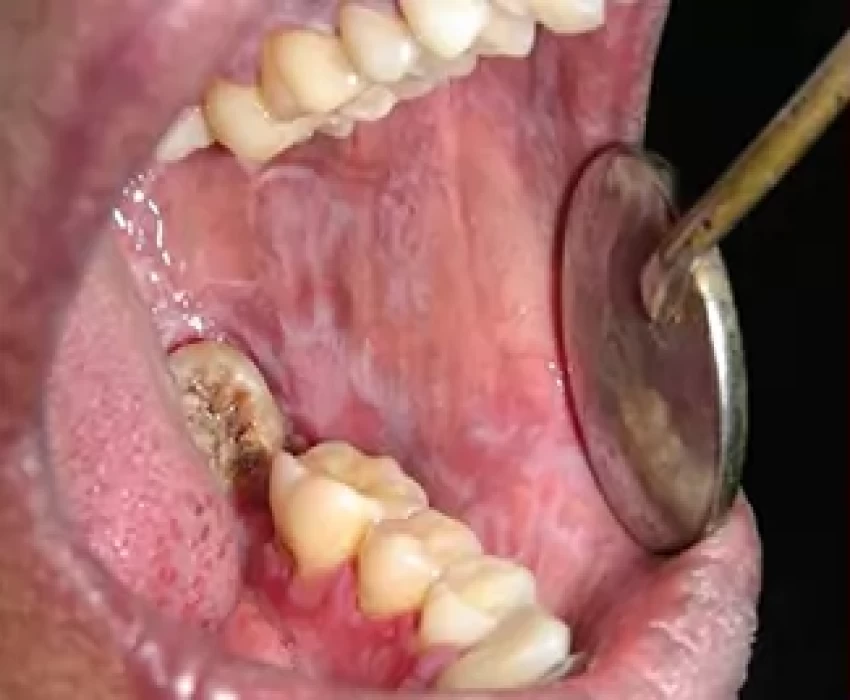 saraswati dental college