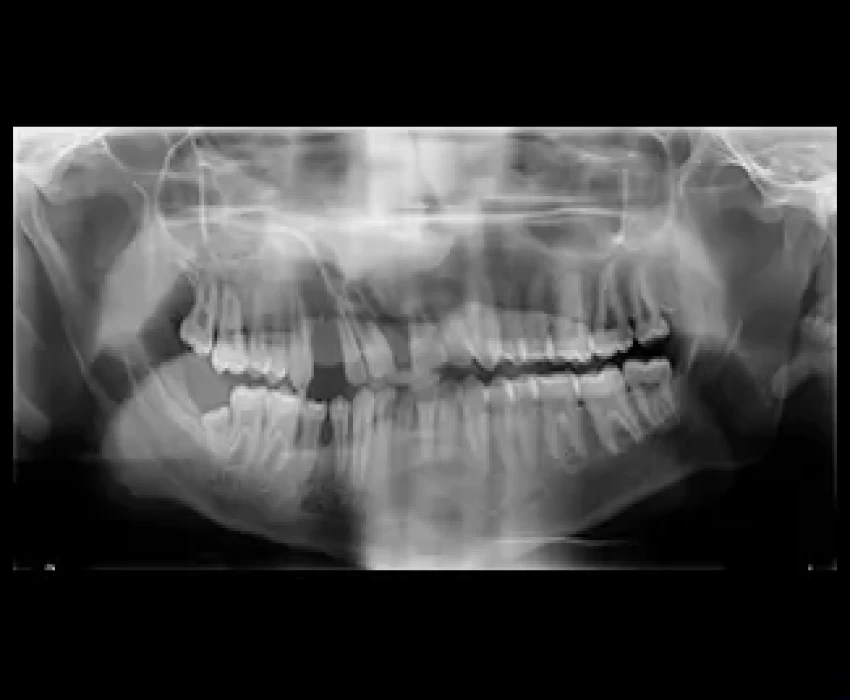 saraswati dental college