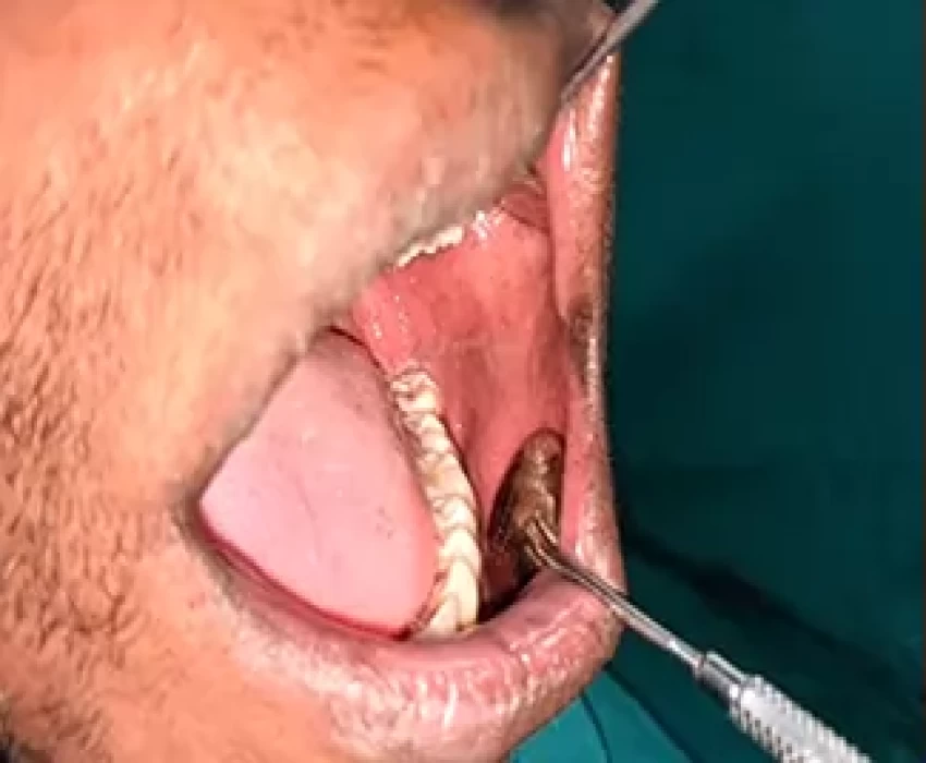 saraswati dental college