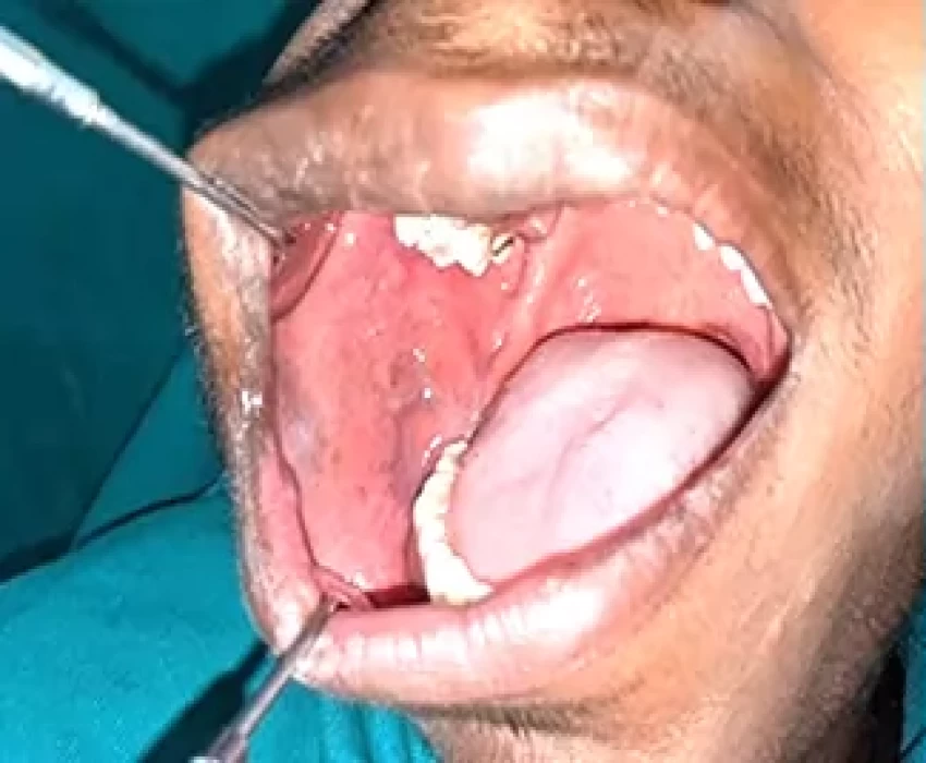 saraswati dental college