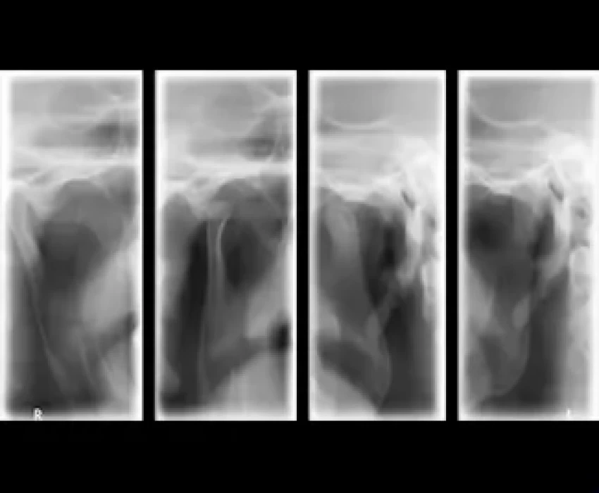 saraswati dental college