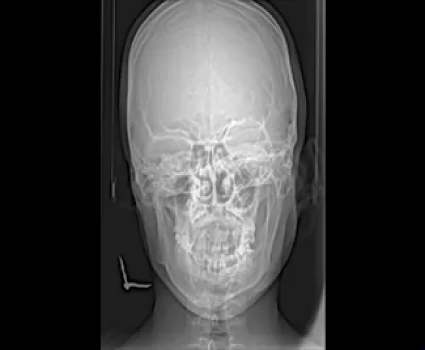 saraswati dental college