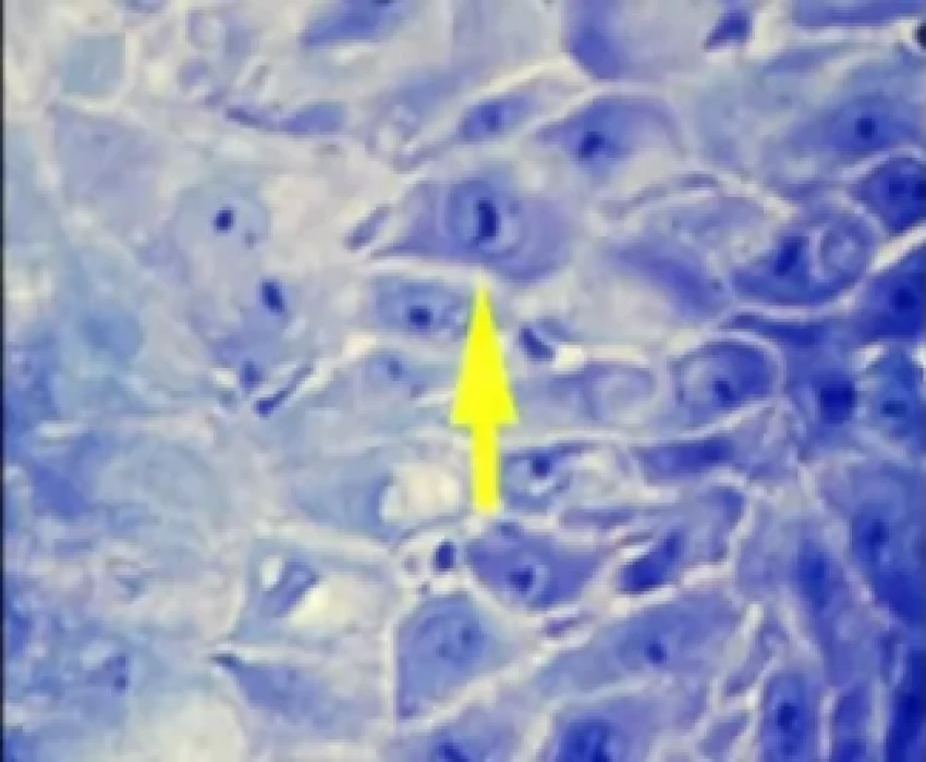 saraswati dental college