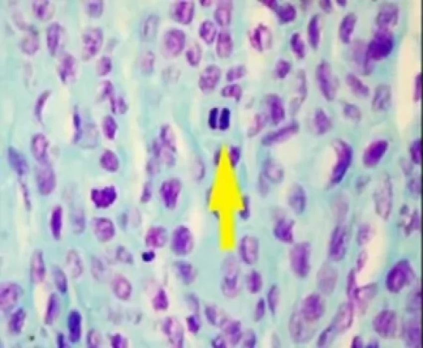 saraswati dental college