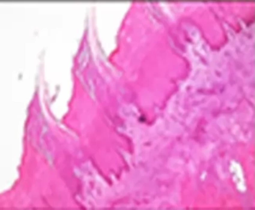 saraswati dental college