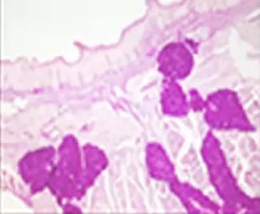 saraswati dental college