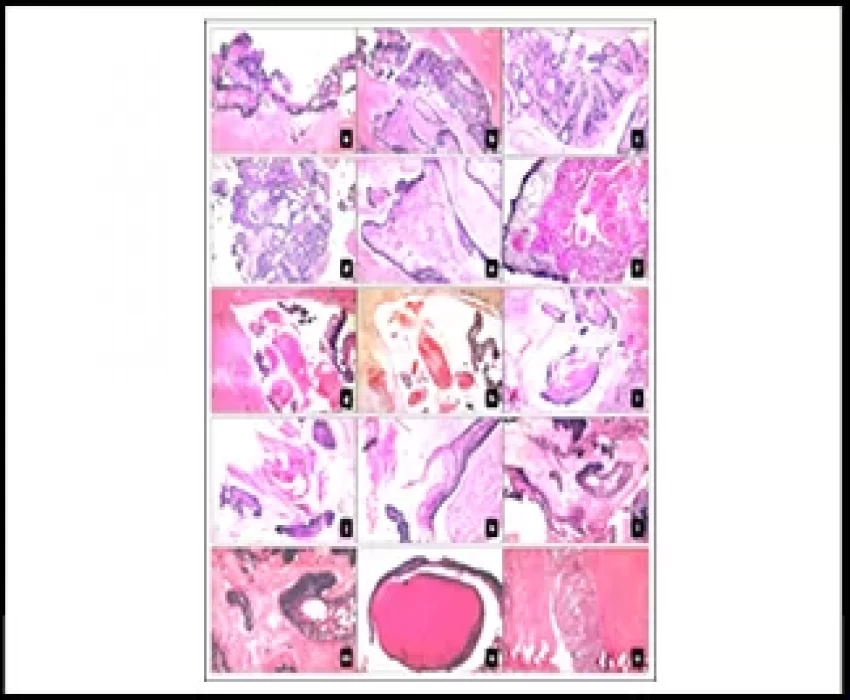 saraswati dental college