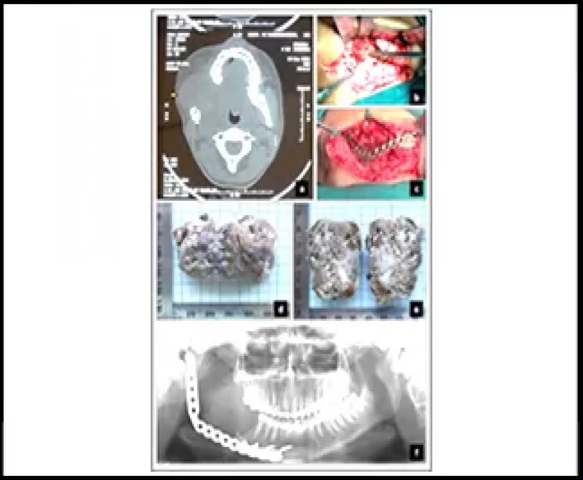 saraswati dental college
