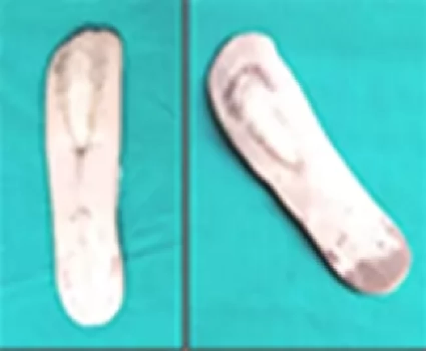 saraswati dental college