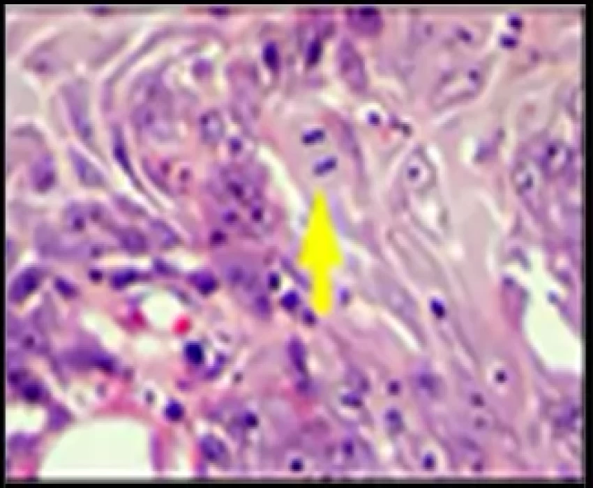 saraswati dental college