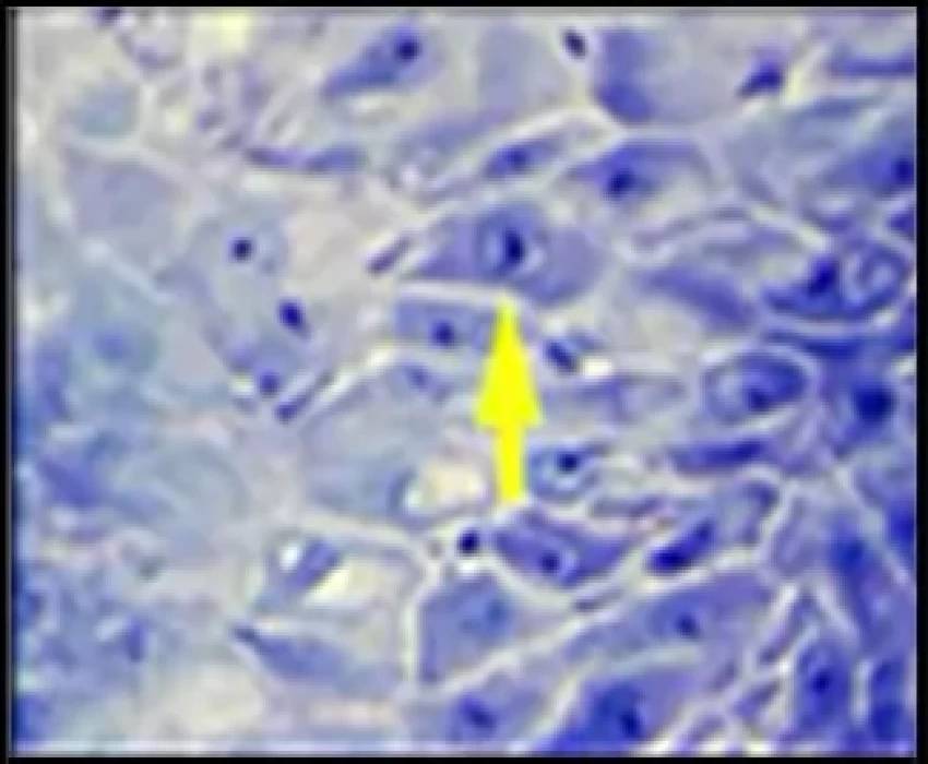 saraswati dental college