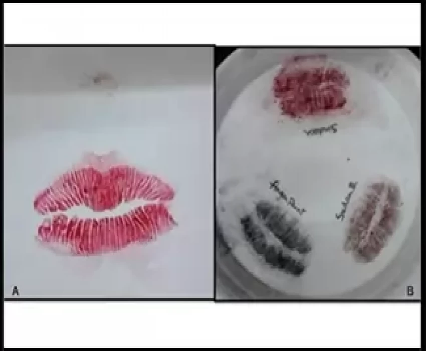 saraswati dental college