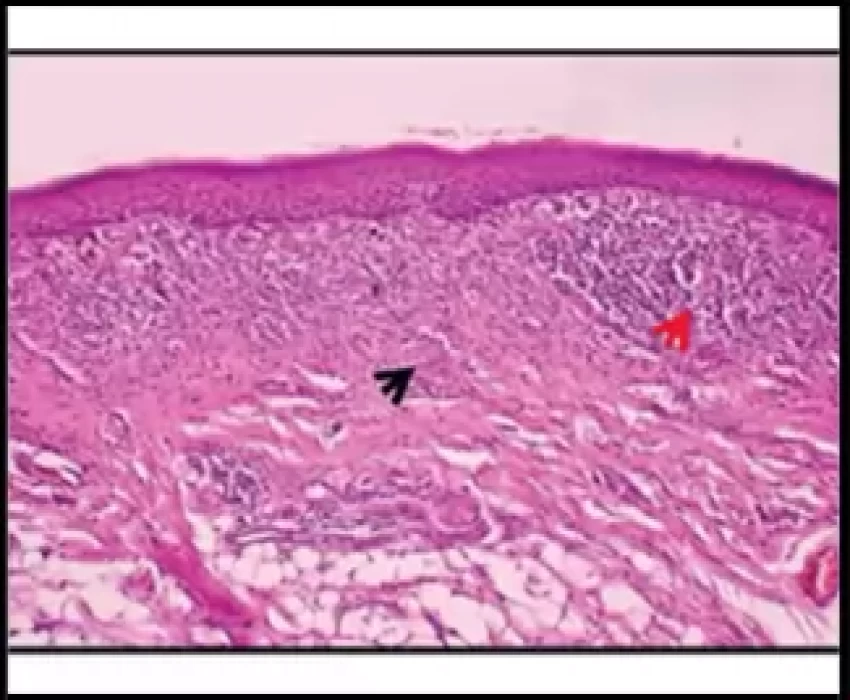 saraswati dental college