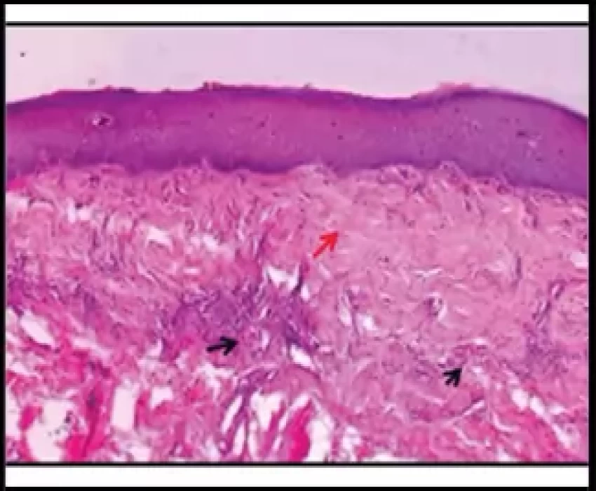 saraswati dental college