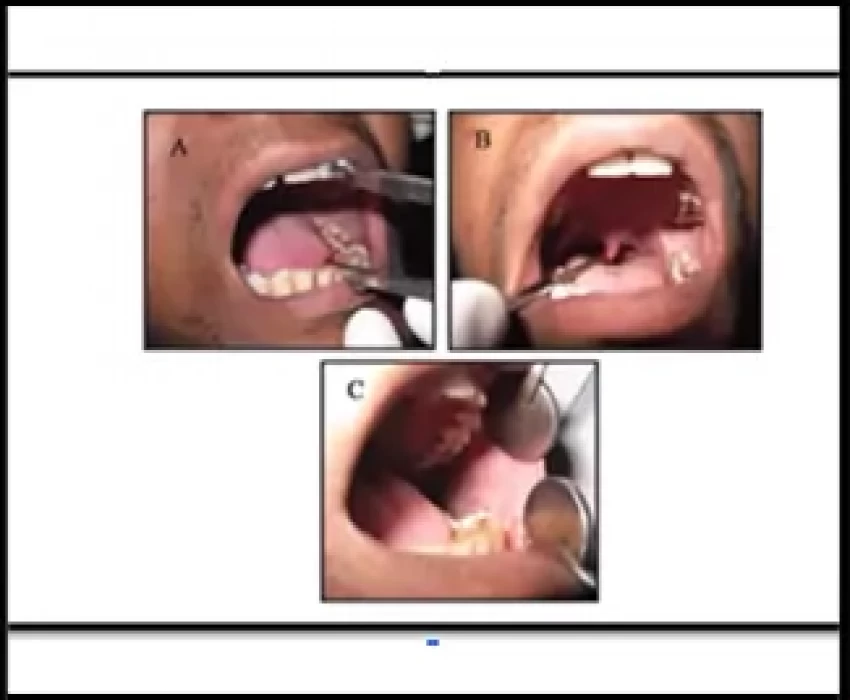 saraswati dental college